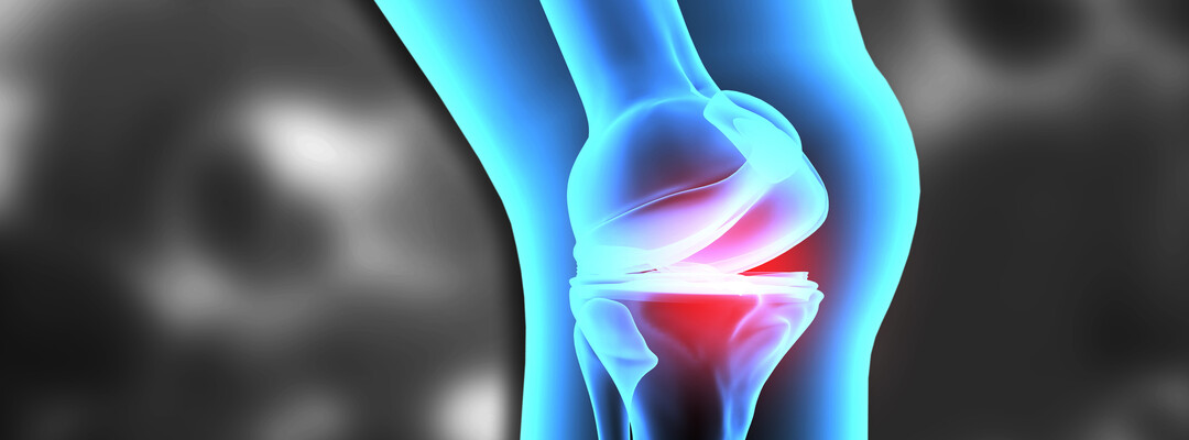 In Vitro Generation of an Osteochondral Interface